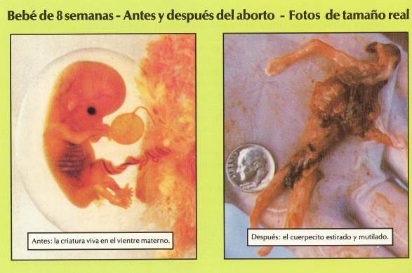 El tratamiento del alcoholismo por el preparado